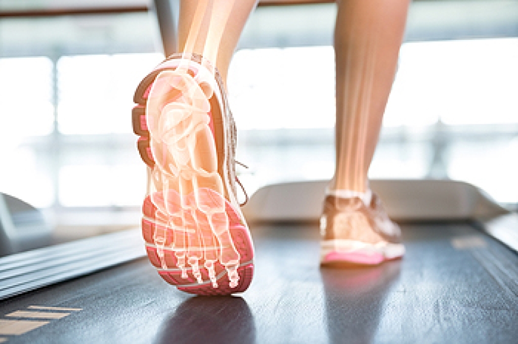 Improving Foot Strike on a Treadmill for Better Performance