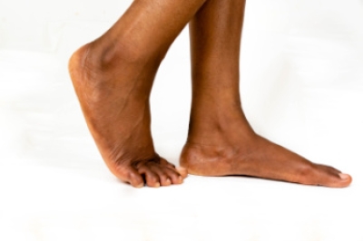 Definition of Flat Feet